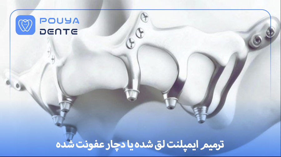 Repair of a loose implant