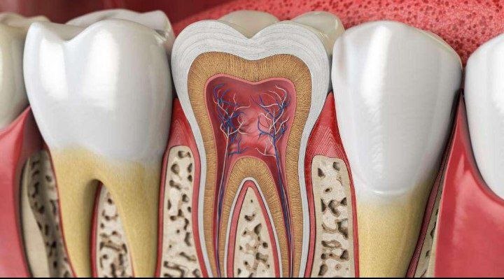 Implants or tooth preservation