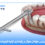 initial-implant-stability