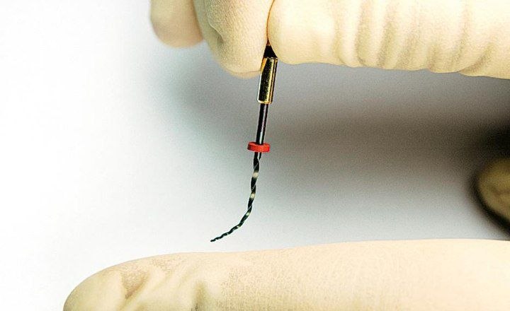 Rotary file stuck inside the tooth canal