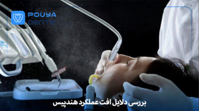 Handpiece performance loss