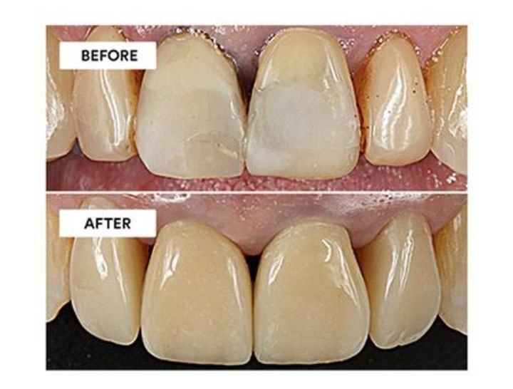 Composite color change
