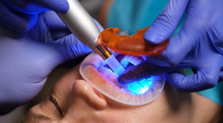 Composite color change