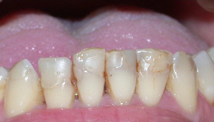 Composite color change