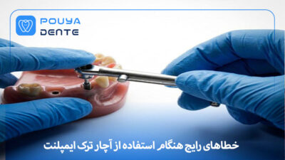 implant-torque-wrench