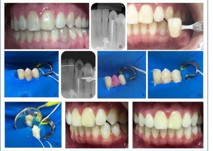 Bleaching agents