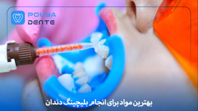 Tooth bleaching agents