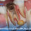 tooth-root-cyst