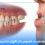 dental-malocclusion